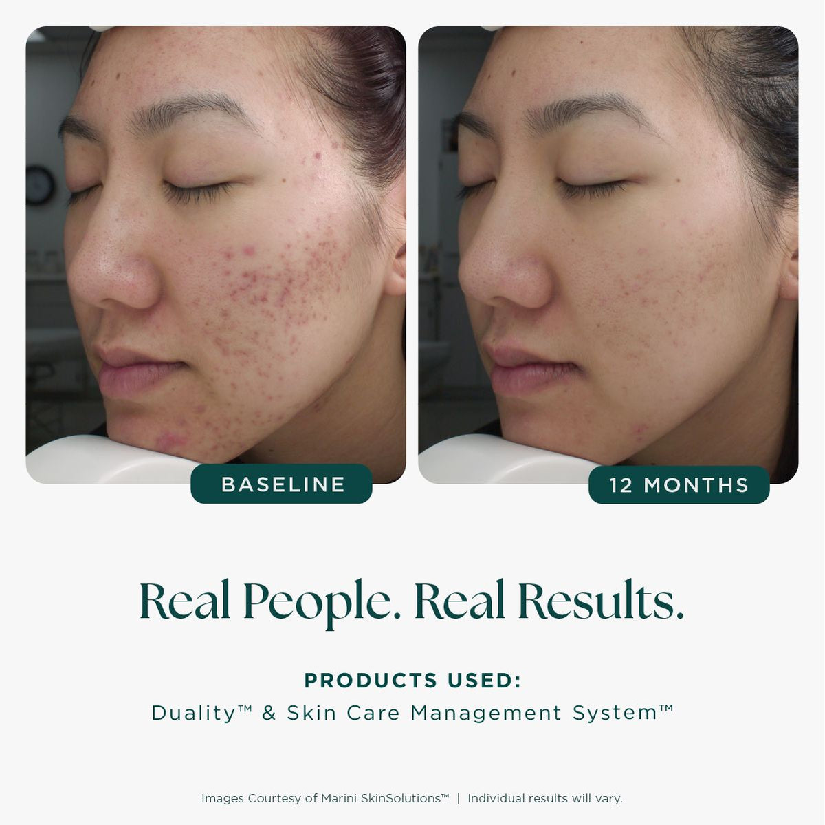 Marini SkinSolutions Duality