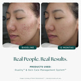 Marini Skin Solutions Age Intervention Duality