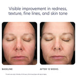 PCA Skin Triple Exfoliation Peel Pads